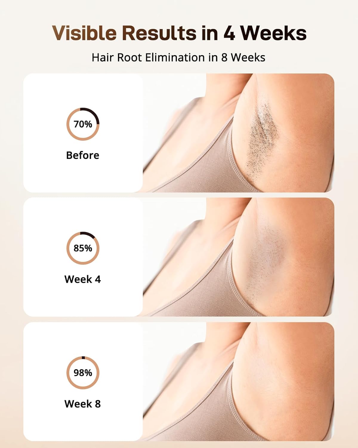 AMOTAOS IPL Laser Hair Removal